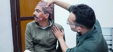 सुर्खेतमा भोलिदेखि ‘नबिल निःशुल्क जलन उपचार शिविर’